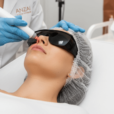 Laserterapia para rejuvenescimento facial: Atrai pacientes interessados em estímulo de colágeno e melhora da textura da pele, Laserterapia em São José dos Campos